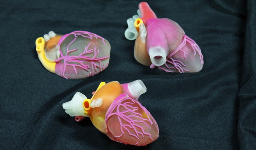 Impression 3D dans le pré opératoire