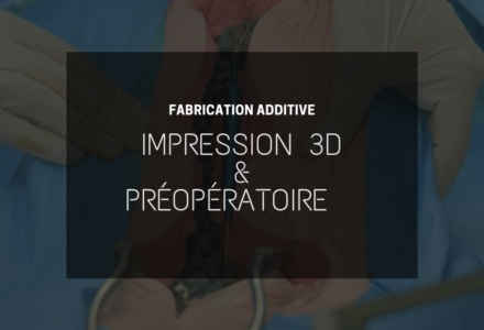 Impression 3D et préopératoire : des solutions pour la santé